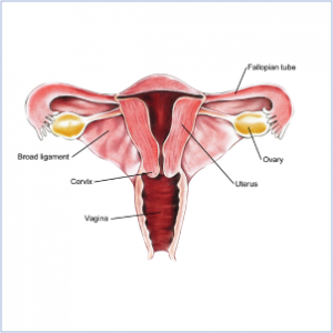 ovary cancer1